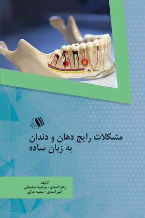 مشکلات رایج دهان و دندان به زبان ساده